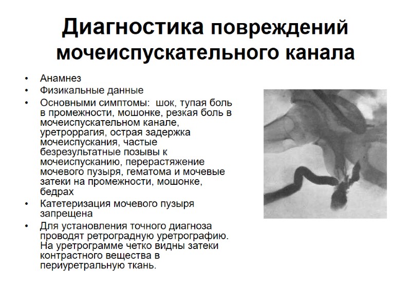 Диагностика повреждений мочеиспускательного канала Анамнез Физикальные данные Основными симптомы:  шок, тупая боль в